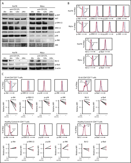 Figure 4. The blockade of CD137-CD137L interactions suppresses phosphorylation of AKT, ERK1/2, p38 MAPK, and JNK, and expression of Bcl-2 and p-Bad. (A) Western blotting analysis was conducted on the lysates of Hut78 and MyLa cells treated with anti-CD137L–neutralizing antibody (5 μg/mL) or isotype control for 0, 6, 12, or 24 hours. Phosphorylation of AKT, ERK1/2, p38 MAPK, and JNK, and expression of Bcl-2 and p-Bad were measured. (B-C) Hut78, MyLa cells, and PBMCs from 4 SS patients as well as 3 healthy controls were treated with anti-CD137L–neutralizing antibody (5 μg/mL) or isotype control for 24 hours. Expression levels of p-AKT, p-ERK1/2, p-p38 MAPK, p-JNK, Bcl-2, and p-Bad were determined by intracellular flow cytometry in Hut78, MyLa cells (B), CD4+CD7− T cells from PBMCs of SS patients and CD4+ T cells from healthy controls (C). The MFI expression was normalized against the MFI expression of isotype-treated cells. Representative results are shown. *P < .05, **P < .01