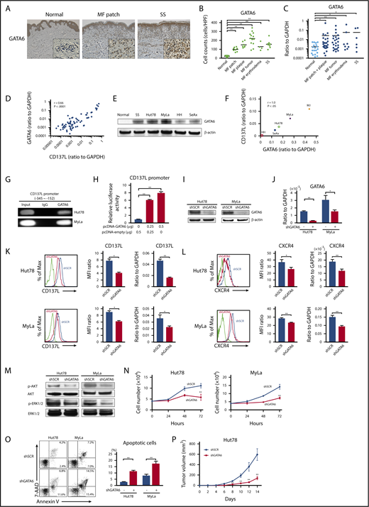 Figure 6. GATA6 acts as an oncogenic gene in CTCL tumor cells through directly regulating CD137L expression. (A) GATA6 expression in lesional skin of CTCL was determined by immunohistochemistry. Diaminobenzidine was used for visualizing the staining and counterstaining with Mayer hematoxylin was performed. Representative results are shown (original magnification ×100). Insets, High-magnification images (original magnification ×400). (B) GATA6+ cells were counted per high-power field (×400). (C) Quantitative RT-PCR was performed to measure expression levels of GATA6 using mRNA extracted from CTCL lesional skin (n = 57; 51 MF cases and 6 SS cases) and healthy skin (n = 20). (D) A correlation between GATA6 and CD137L mRNA levels in CTCL lesional skin. (E) Western blotting analysis for GATA6 protein expression was conducted on the lysates of PBMCs from 1 SS patient as well as healthy controls and CTCL cell lines. (F) A correlation between GATA6 and CD137L mRNA levels in CTCL cell lines. (G) ChIP assay in Hut78 and MyLa cells was performed with anti-GATA6 antibody and the primer specific for the designed area of the CD137L gene promoter. (H) Luciferase reporter assay using CD137L promoter constructs. HEK293 cells were cotransfected with CD137L promoter constructs and GATA6 expression vector. Forty-eight hours after transfection, luciferase activity was measured. (I-P) Hut78 and MyLa cells were transfected with either GATA6-targeting shRNA (shGATA6) or control scrambled shRNA (shSCR). (I-J) GATA6 expression levels were assayed by western blotting analysis (I) and quantitative RT-PCR (J). (K-L) CD137L (K) and CXCR4 (L) expression levels were determined by flow cytometric analysis and quantitative RT-PCR. Representative results are shown. (M) Western blotting analysis was conducted on the lysates of shGATA6 and shSCR cells. Expression levels of p-AKT and p-ERK1/2 were measured. (N) shGATA6 or shSCR transduced cells (4.0 × 104 per well) were cultured for 72 hours. Viable cells were counted at indicated time points by trypan blue exclusion. (O) Apoptosis (Annexin V+ and 7-AAD−) in shGATA6 and shSCR cells was evaluated with Annexin V and 7-AAD staining for flow cytometric analysis. Data are presented as mean plus or minus SD. *P < .05, **P < .01. (P) Hut78-shGATA6 or Hut78-shSCR cells (5.0 × 106) were injected into NSG mice. The tumor volume was calculated using the equation: V = π (L1 × L22)/6, where V = volume (mm3), L1 = longest diameter (mm), and L2 = shortest diameter (mm). Values are means plus or minus SEM (n = 12). *P < .05, **P < .01 by the Mann-Whitney U test compared with control group.