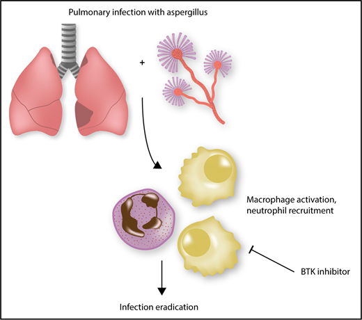 Eradication of A fumigatus is inhibited by ibrutinib. Effective clearance of Aspergillus requires macrophage activation and subsequent neutrophil recruitment. This activation is a Btk-dependent process, and inhibitors of Btk, such as ibrutinib, preclude effective clearance of A fumigatus, predisposing patients to invasive infection.