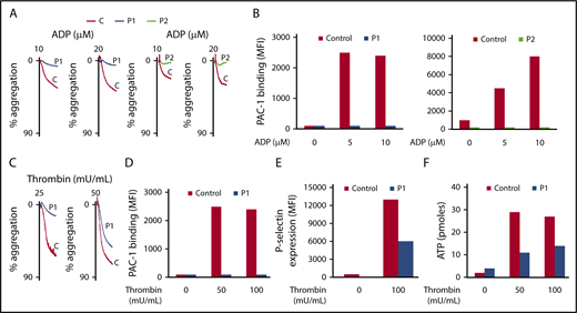 Figure 3. Platelet aggregation, secretion, and αIIbβ3 activation induced by ADP or thrombin are impaired in both patients. (A-C) Aggregation of washed platelets was initiated by various concentrations of ADP (10 and 20 μM) and thrombin (25 and 50 mU/mL) for 3 minutes. Aggregation was expressed as the percentage change in light transmission, with the value of the blank (buffer without platelets) set at 100%. Tracings are representative of at least 2 experiments per patient. (B-D) Quantification of activated αIIbβ3 at the surface of washed platelets was assessed by flow cytometry by binding of the specific monoclonal antibody (mAb) PAC1 to control and P1 and P2 platelets upon activation with ADP (5 and 10 μM) and thrombin (50 and 100 mU/mL). (E-F) Quantification of P-selectin exposure was assessed by flow cytometry using anti-P-selectin antibody and dense granule release with an ATP determination kit, respectively, to control and P1 platelets upon activation by thrombin (50 and 100 mU/mL). Results are representative of 2 experiments for each patient.