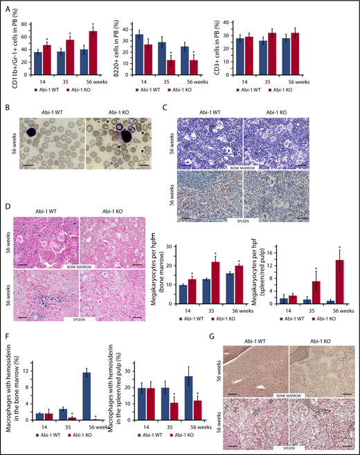 Figure 3. Abi-1 deficiency results in age progressive increase in circulating granulocytes, anisopoikilocytosis, megakaryocytosis, loss of stainable iron, and fibrosis. (A) Fluorescence-activated cell sorter analysis of CD11b+/Gr-1+, B220+, and CD3+ populations in the peripheral blood of Abi-1WT and Abi-1KO mice, performed at 14, 35, or 56 weeks of age, 20 Abi-1WT and 20 Abi-1KO sex-matched mice were evaluated at each point. (B) Wright staining of representative blood smears obtained from Abi-1KO and Abi-1WT mice at 56 weeks of age; teardrop cells are marked with arrows. Similar results were observed in blood smears of at least 12 sex-matched Abi-1WT or Abi-1KO mice. Magnification ×100, bars correspond to 20 μm. Images were obtained using a Zeiss Axiophot microscope and Zeiss Pan-Apochromat 100×/1.40 oil lens. Representative (C) hematoxylin and eosin or (D) Prussian blue stains of bone marrow from femurs and spleen sections of 56-week-old Abi-1WT or Abi-1KO animals. Similar results were observed in at least 12 sex-matched Abi-1WT or Abi-1KO mice. Bars correspond to 100 μm. Images were obtained using a Zeiss Axiophot microscope with Zeiss Pan-Apochromat 20×/1.0 lens. (E) Average number of megakaryocytes per high power field (hpf) and (F) percentage of macrophages with hemosiderin in the bone marrow and spleen/red pulp evaluated in 14-, 35-, and 56-week-old Abi-1WT or Abi-1KO animals; 6 sex-matched animals were evaluated per age group per genotype. Representative (G) Gomori reticulin staining of the bone marrow from femurs and spleen sections of 56-week-old Abi-1WT or Abi-1KO animals (black stain). Similar results were obtained for at least 12 sex-matched animals per group. Bars correspond to 100 μm. Images were obtained using Zeiss Axiophot microscope with Zeiss Pan-Apochromat 20×/1.0 lens. *P < .05.