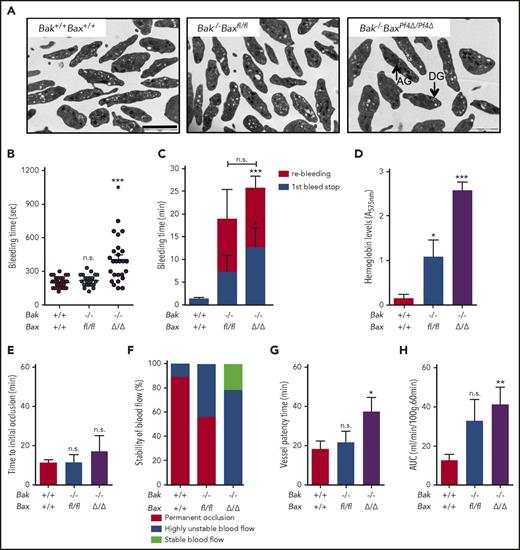 Figure 3. Increased bleeding time and unstable thrombi in the absence of platelet apoptosis. (A) Representative images of platelets from Bak+/+ Bax+/+, Bak−/− Baxfl/fl, and Bak−/− BaxPf4∆/Pf4∆ mice visualized by transmission electron microscopy. Scale bar, 2 µm. Dense granule (DG) and α granule (AG) are indicated by arrows. (B) Tail bleeding time assessed after tail incision (5 mm long and 1 mm deep). Bleeding was monitored by blotting with filter paper every 30 sec. Each symbol represents an individual mouse. (C) Tail bleeding time into 37°C saline (3-mm tail amputation) and (D) blood loss (hemoglobin levels). Blue bars in C represent the initial cessation of bleeding, and red bars represent length of rebleeding. n = 8 mice per genotype. (E-H) Electrolytic thrombosis model. (E) Time to initial occlusion, (F) stability of blood flow, (G) vessel patency, and (H) blood flow (60 minutes postinjury). n = 9 mice per genotype. Data are presented as mean ± SEM. Unpaired Student t test with 2-tailed P values. *P < .05; **P < .005; ***P < .001; n.s., not significant.