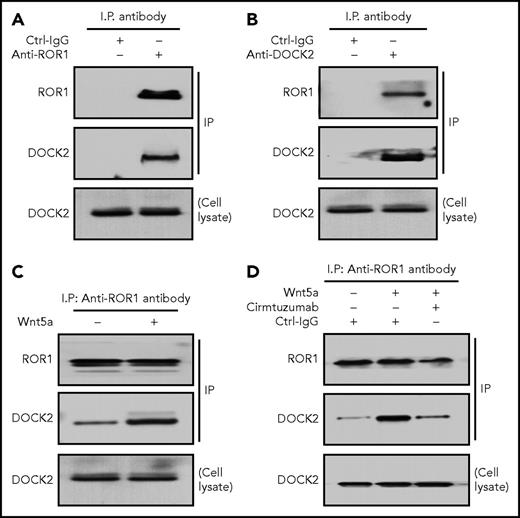 Figure 1. Association of ROR1 with DOCK2 in primary CLL cells. (A) Immunoblot analysis of anti-ROR1 (cirmtuzumab) ip or control IgG (Ctrl-IgG) ip, as indicated at the top, using lysates prepared from freshly isolated primary CLL cells (representative of 3 patients); the membranes were probed with anti-ROR1 or anti-DOCK2 antibody, as indicated on the left. An immunoblot of the whole-cell lysates of the CLL is provided in the bottom panel. (B) Immunoblot analysis of anti-DOCK2 ip or Ctrl-IgG ip, as indicated at the top, using lysates prepared from freshly isolated primary CLL cells (representative of 3 patients); the membranes were probed with anti-ROR1 or anti-DOCK2 antibody, as indicated on the left. An immunoblot of the whole-cell lysates of the CLL is provided in the bottom panel. (C) Immunoblot analysis of anti-ROR1 (cirmtuzumab) ip, using lysates prepared from overnight, serum-starved primary CLL cells (representative of 3 patients) that subsequently were treated for 30 minutes without (−) or with (+) Wnt5a (100 ng/mL), as indicated on the top; the membranes were probed with anti-ROR1 or anti-DOCK2 antibody, as indicated on the left. An immunoblot of the whole-cell lysates of the CLL is provided in the bottom panel. (D) Immunoblot analysis of anti-ROR1 (4A5) ip or Ctrl-IgG ip, as indicated at the top, using lysates prepared from freshly isolated primary CLL cells (representative of 3 patients) that had been treated with cirmtuzumab (10 μg/mL), without (−) or with (+) Wnt5a (100 ng/mL), as indicated on the top; membranes were probed with anti-ROR1 or anti-DOCK2 antibody, as indicated on the left. An immunoblot of the whole-cell lysates of the CLL treated with cirmtuzumab and probed with anti-DOCK2 mAb is provided in the bottom panel.