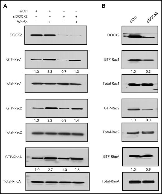 Figure 4. DOCK2 factors in Wnt5a-induced activation of Rac1/2, but not RhoA. (A) Immunoblot analysis of lysates prepared from freshly isolated primary CLL cells transfected 72 hours previously with control siRNA or siRNA targeting DOCK2, then treated without (−) or with (+) Wnt5a; expression of DOCK2, total Rac1/2, RhoA, and activated Rac1/2, RhoA was measured, as indicated on the left (representative of 3 patients). The numbers between 2 lanes are ratios of band IOD of GTP-Rac1/2 or GTP-RhoA vs total Rac1/2 or RhoA, respectively. (B) Immunoblot analysis of lysates prepared from MEC1-ROR1 cells transfected 72 hours previously with control siRNA or siRNA targeting DOCK2, then treated without (−) or with (+) Wnt5a; expression of DOCK2, total Rac1/2, RhoA, and activated Rac1/2, RhoA was measured, as indicated on the left. The numbers between 2 lanes are ratios of band IOD of GTP-Rac1/2 or GTP-RhoA vs total Rac1/2 or RhoA, respectively.