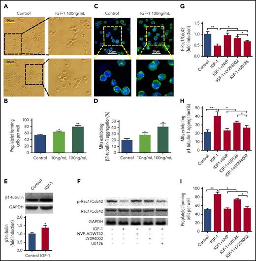 Figure 3. IGF-1 promotes proplatelet formation. CD34+ cells cultured with rhTPO for 10 days were purified for MKs, which were used in subsequent experiments. (A-B) Typical PPF from MKs captured by phase contrast imaging after treatment with 10 or 100 ng/ml rhIGF-1 for 4 days. (C-D) Tubulin cytoskeleton distribution in MKs after rhIGF-1 treatment. MKs were stained with β1-tubulin (green) and DAPI (blue). (E) Immunoblot analysis of β1-tubulin expression in MKs treated with or without rhIGF-1. (F-G) Phospho-Rac1/Cdc42 expression in MKs blocked with 0.5 μM NVP-ADW742, 10 μM LY294002, or 20 μM U0126 and then treated with rhIGF-1 for 15 minutes. (H-I) Number of MKs exhibiting β1-tubulin aggregation (H) and PPFs (I) pre-blocked with 0.5 μM NVP-ADW742, 10 μM LY294002, or 20 μM U0126 for 20 minutes followed by rhIGF-1 treatment. *P < .05, **P < .01.