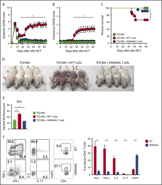 Figure 1. Notch blockade in mature T cells prevents sclerodermatous cGVHD. BALB/c mice were lethally irradiated (8-8.5 Gy), followed by transplantation of B10.D2-Thy1.2 TCD BM (light green circle), TCD BM with 12 × 106 B10.D2-Thy1.1 WT splenocytes (red circle), or 12 × 106 B10.D2-DNMAML splenocytes (blue circle), followed by monitoring with systemic or skin-specific clinical GVHD scores. B10.D2-DNMAML T cells cannot respond to canonical Notch signals. (A) Mean systemic clinical GVHD scores. *P < .01 (WT vs DNMAML T cells and WT T cells vs TCD BM only; 1-way ANOVA). (B) Mean skin-specific clinical GVHD scores; *P < .01 (WT vs DNMAML T cells and WT T cells vs TCD BM only; 1-way ANOVA). (C) Overall survival; *P < .001 (WT vs DNMAML T cells and WT T cells vs TCD BM only; log-rank test). n = 20 mice/group, pooled from 4 experiments. (D) Representative images of recipient mice on day 35 show absence of Scl-cGVHD features in TCD BM and DNMAML T-cell recipients. (E) Histopathological assessment of dermal thickness, a hallmark of skin cGVHD (n = 14, 3 experiments). *P < .01 (1-way ANOVA). (F) Flow cytometric assessment of inflammatory cytokine production and FoxP3 expression in donor-derived spleen T cells (day 6). Representative contour plots (left). Numbers indicate the percentage of events falling within indicated rectangular gates. Cumulative quantification (right) (n = 10 mice/group, from 3 experiments). *P < .001 (2-tailed unpaired Student t test). IFN, interferon; IL, interleukin; TNF, tumor necrosis factor.
