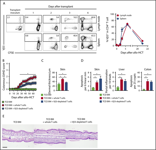 Figure 3. In the Scl-cGVHD model, immunodominant and pathogenic alloreactive Vβ3+ T cells expand rapidly post-transplant and their elimination mitigates Scl-cGVHD. BALB/c mice were lethally irradiated and transplanted with B10.D2-Thy1.2 TCD BM (107 cells) supplemented with 12 × 106 CFSE-labeled B10.D2-Thy1.1 WT splenocytes. (A) Expression of Vβ3 in donor-derived CD90.1+CD4+ T cells in spleen or lymph nodes at the indicated time points after transplant. Vβ3+ T cells proliferated and expanded rapidly to become the majority of donor T cells on day 6, before their subsequent contraction. Representative flow cytometry plots, with numbers indicating the percentage of Vβ3+ cells among donor-derived CD4+ T cells (left). (B-C) B10.D2→BALB/c chimeras were generated by transplanting TCD BM only (light green circle) vs TCD BM with 3 × 106 WT T cells depleted of Vβ3+ T cells (blue circle) or sham manipulated (red circle). (B) Cutaneous cGVHD manifestations were monitored biweekly. Note significant cutaneous GVHD score reduction in mice receiving Vβ3-depleted T cells as compared with whole T-cell recipients. *P < .05 for all comparisons (1-way ANOVA). (C-D) Histopathologic analysis of animals depicted in panel (B). (C-D) Cumulative data show decreased pathological hallmarks of cGVHD (C) with transplantation of Vβ3-depleted T cells, without corresponding impact on the severity of aGVHD (D). *P < .05 (1-way ANOVA). (E) Representative microphotographs of hematoxylin and eosin–stained skin sections showing increased dermal thickness in the whole T cell as compared with TCD BM recipients, with decreased thickness in recipients of Vβ3-depleted T cells (ear lobes, day 60). Scale bar represents 100 µm.