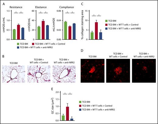 Figure 7. Notch2 inhibition is a potential therapeutic strategy in BO-cGVHD without the detrimental side effects characteristic of Notch1 targeting. Following conditioning, B10.BR recipients were transplanted with B6 WT TCD BM cells (107 cells) supplemented with 74 × 103 B6 WT T cells. Treatment with control vs anti-NRR2 antibodies was given with biweekly injections for 7 weeks, before pulmonary testing was completed. (A) Pulmonary functions tests at day 49 after allo-HCT showing beneficial effects of Notch2 blockade with anti-NRR2 antibodies. (B-C) Anti-NRR2 blockade decreases peribronchiolar collagen deposition in BO-cGVHD. Representative microphotographs of Masson’s trichrome stained lung sections taken at ×200 magnification (B). Cumulative data (C) showing quantification of collagen deposition expressed as a ratio of blue over total stained area. (D-E) Peanut agglutinin staining in the spleens of TCD BM recipients vs recipients of TCD BM plus T cells treated with isotype control or anti-NRR2 antibodies show dampened GC B-cell responses in the spleens of anti-NRR2 treated recipients. Representative microphotographs taken at ×200 magnification (D) and cumulative data (E) quantifying average GC size. *P < .05 (1-way ANOVA).