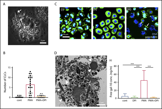Figure 2. CLC formation in EETosis in vitro. (A) Cytoplasmic CLC formation in an eosinophil undergoing ETosis (arrow). Eosinophils were observed with time-lapse, phase-contrast imaging following IL-5 and platelet activating factor stimulation. Images were captured from supplemental video 1. (B) CLCs were associated with EETosis. Eosinophils were stimulated with PMA (10 ng/mL) with/without DPI for 120 minutes. CLCs were counted using an inverted microscope (40× objective, Eclipse TE300, Nikon). A total of 240 fields from 4 independent donors were studied. The bar graph represents the mean ± standard deviation. (C) Cellular galectin-10 localization during EETosis. PMA stimulated cells were fixed at 15, 45, and 120 minutes and stained with anti-galectin-10 Ab (green). At 15 minutes (i), galectin-10 was eccentrically located in adherent eosinophils. Galectin-10 was homogeneously distributed in cytoplasm at 45 minutes (ii). Note the loss of the typical bilobed nuclear shape. At 120 minutes (iii), cytoplasmic galectin-10 had disappeared and CLCs (arrows) could be recognized. ETs (filamentous DNA in blue) were also evident. EVs (supplemental Figure 7B) were out of focus. (D) Extracellular CLC formation. (i) Stacked EETosis cells form varied sizes of CLCs. Eosinophils (5 × 106 cells in 1.5 mL) were stimulated with PMA (10 ng/mL) in round-bottomed microtubes for 3 hours, followed by fixation and processing for TEM. Sectioned CLCs of variable size (arrowheads) were observed. (ii) Free galectin-10 levels in culture supernatants. Eosinophils were stimulated with PMA with/without DPI for 3 hours, and culture supernatants were recovered by centrifugation at 10 000g for 10 minutes to remove vesicles, free granules, and CLCs. The graph represents the mean ± standard deviation from 6 different donors. ***P < .001. cont, nonstimulated control.
