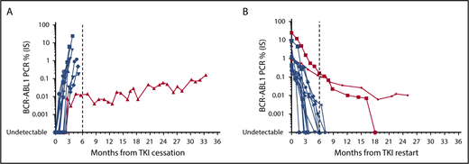 Figure 1. Molecular profile of 15 patients at our institution attempting and failing TFR. (A) Molecular relapse after TKI cessation. (B) Molecular response after TKI recommencement. Blue indicates typical molecular responses showing rapid rise or decline. Red indicates typical molecular responses showing slow rise or decline.