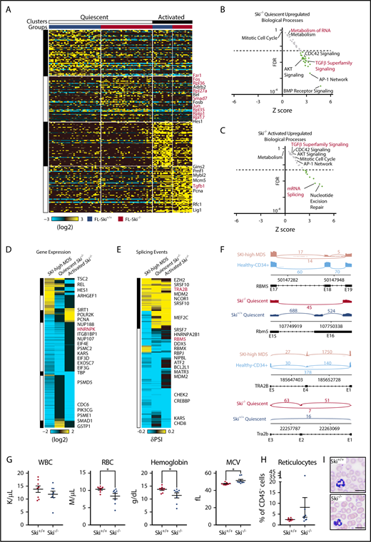 Figure 4. Loss of Ski is sufficient to upregulate TGF-β signaling and deregulate splicing in HSC. (A) Heatmap of scRNA-Seq from SLAM HSCs (94 cells). Each column represents a single cell and each row represents 1 gene. Top: Clusters and groups; right: key genes (supplemental Figure 3A). (B-C) Scatter plot displaying the FDR vs Z-score of individual biological processes enriched within the differentially expressed genes in Ski−/− HSCs compared with Ski+/+ HSCs. Each dot represents a biological process, and the dotted line indicates an FDR value of 0.05 (supplemental Figure 3B-C). (D) Comparative analysis of differential gene expression. Heatmap of conserved differential gene expression between SKI-high MDS patient samples (vs normal CD34+ controls) and Ski−/− HSCs (vs Ski+/+ HSCs). Each row represents a single gene; (right) key genes are annotated. (E) Comparative analysis of alternative splicing. Heatmap of alternative splicing events that are conserved between SKI-high MDS patient samples (vs normal CD34+ controls) and pseudobulk of single cells of Ski−/− HSCs (vs Ski+/+ HSCs). Each row represents a single gene; right: key genes are annotated. (F) Conserved alternative splicing examples: representative sashimi plots of the RBM5/Rbm5 and TRA2B/Tra2b loci. (G-I) Peripheral blood analysis of noncompetitive transplant recipients at 10 months posttransplant with Ski+/+ or Ski−/− FL cells. (G) Complete blood counts. (H) Quantitation of the fraction of peripheral blood reticulocytes as a percentage of all CD45– cells. (I) Representative peripheral blood smears (8 biological replicates per group). The scale bars represent 10 μm. (G-H) Data are displayed as mean ± SEM. *P < .05. MCV, mean corpuscular volume; RBC, red blood cell; WBC, white blood cell count.