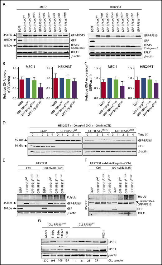 Figure 1. Recurrent RPS15 mutations alter protein stability. (A) MEC-1 and HEK293T cell lines stably expressing the indicated GFP-fusion constructs were subjected to western blot analysis with anti-GFP (for GFP and GFP-RPS15 detection), RPS15, RPL11, and β-actin. Note that RPL11 detection was carried out with the same samples run in parallel on an identical blot. (B) Relative DNA levels of transduced GFP-RPS15 (wild-type and mutants) lentiviral vectors in MEC-1 and HEK293T cells determined by qPCR analysis. ACTB was used as normalization control of endogenous genomic DNA. Data are shown as the mean of 3 independent experiments + standard error of the mean (SEM). (C) Real-time qPCR against GFP-fused RPS15 constructs in the same cell lines as in (B). β-Actin mRNA levels were used as normalization controls. Data are shown as the mean of ≥3 independent determinations + SEM. (D) HEK293T cells stably expressing the GFP-RPS15 forms were treated for the indicated times with 100 mg/mL cycloheximide (CHX) and 100 nM actinomycin D (ACTD). GFP, GFP-RPS15, and β-actin (as a loading control) were detected by immunoblotting. A representative western blot of 2 independent experiments is shown. (E) HEK293T cells stably expressing the GFP-RPS15 forms were treated or not with 100 nM bortezomib (Bz) for 24 hours and subjected to western blot analysis with antibodies against polyubiquitin (PolyUb), RPS15, GFP, and β-actin as a loading control. A representative western blot of 3 independent experiments is shown. (F) Wild-type and mutant GFP-RPS15 forms were transiently coexpressed with 4xHA-tagged ubiquitin in HEK293T cells for 24 hours and incubated in the absence or presence of 100 nM Bz for an additional 12 hours. GFP-tagged RPS15 forms were immunoprecipitated with anti-GFP antibody. Then, hemagglutinin (HA; to detect polyubiquitination), GFP, GFP-RPS15, and RPL11 (as positive control of coimmunoprecipitation) were detected by immunoblotting. (G) Western blot analysis with anti-RPS15, RPL11, and β-actin of a cohort of 4 CLL-RPS15WT and 4 CLL-RPS15MUT patient samples, using MEC-1 cells as control.