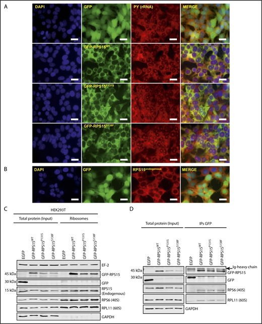 Figure 2. RPS15 mutant proteins are incorporated into ribosomes. (A) Distribution of RPS15 proteins (wild-type and P131S and S138F mutants) fused to GFP in HEK293T cells. rRNA was stained with the RNA-binding dye pyronin Y (PY). Colocalization is shown in merge panels. Scale bars, 20 µm. (B) Immunofluorescence analysis of endogenous RPS15 in GFP-expressing HEK293T cells. Scale bars, 20 µm. (C) Isolation of ribosomes from HEK293T cells stably expressing the GFP-RPS15 constructs and subsequent western blot analysis using antibodies against EF2, GFP, RPS15, RPS6, RPL11, and GAPDH. Note that RPL11, EF2, and GFP detection was carried out with the same samples run in parallel on an identical blot. A representative western blot of 2 independent experiments is shown. (D) Total protein lysates from HEK293T cells stably expressing GFP or the GFP-RPS15 constructs were immunoprecipitated with anti-GFP antibody, and GFP, RPS6 (as a representative ribosomal protein of the 40S subunit), and RPL11 (as a representative ribosomal protein of the 60S subunit) were detected by immunoblotting. Note that RPL11 and RPS6 detection was carried out with the same samples run in parallel on an identical blot. A representative western blot of 2 independent experiments is shown.