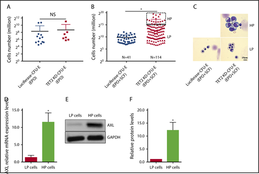 Figure 7. TET2 knockdown led to the SCF-dependent clonal expansion of CFU-E cells. (A) Growth of sorted single luciferase or TET2-knockdown CFU-E cells cultured in the presence of EPO for 7 days. (B) Growth of sorted single luciferase or TET2-knockdown CFU-E cells cultured in the presence of EPO plus SCF for 15 days. Note that cells can be divided into HP and LP populations. (C) Representative cytospin images of erythroblasts from panel B. (D) mRNA levels of AXL in the LP cells (pooled) and HP cells (pooled). (E) Western blot analysis of AXL of pooled LP and HP cells. (F) Quantitative analysis of AXL protein levels from 3 independent experiments. *P < .05. NS, not statistically significant.