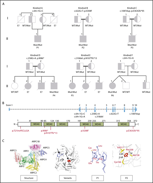 Figure 1. Pedigree of ARPC1B-deficient patients. (A) Genetics and pedigree of families included in the study with reported mutations. Squares: male subjects; circles: female subjects; black filled symbols: patients with mutation; crossed-out symbols: deceased subjects. Each generation is designated by a roman numeral (I-II). No genomic DNA was available for testing for siblings labeled “E?”. (B) Nucleotide positions of mutations identified in index patients and representation of amino acid change caused by the mutations. (C) Crystal structure of the ARP2/3 complex from Bos taurus (access protein data bank: 1K8K), location of variants in the ARPC1B structure and modeling of c.64+1G>C splice donor and p.Val208Phe missense variants in P1 (blue) and P2 (red).