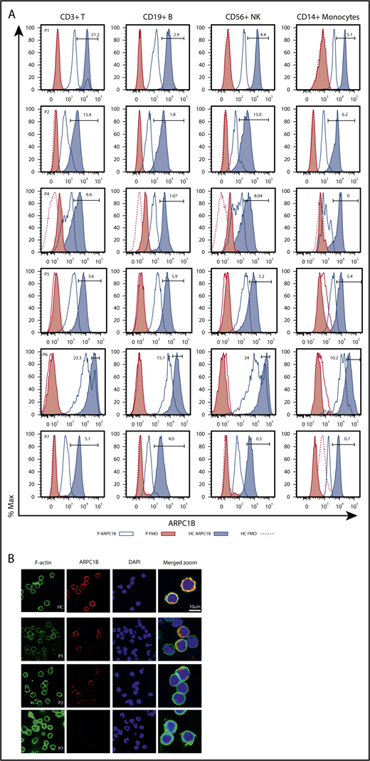 Figure 2. Phenotypical characterization of ARPC1B-deficient patients. (A) Histograms showing ARPC1B expression in T, B, NK cells, and monocytes in patients included in the study (blue lines) and their healthy controls (HC; blue tinted lines) determined by flow cytometry. Red filled lines: negative controls of patients. Red dashed lines: negative controls of HC. Percentage of ARPC1B+ in patients’ cells is indicated. (B) Confocal microscopy of ARPC1B, F-actin, merged with nuclei (DAPI) in a representative field of HC, P1, P2, and P7 (ARPC1B-null patient) peripheral blood lymphocytes. Bar represents 10 μm. Arrows indicate positive staining for ARPC1B and F-actin.