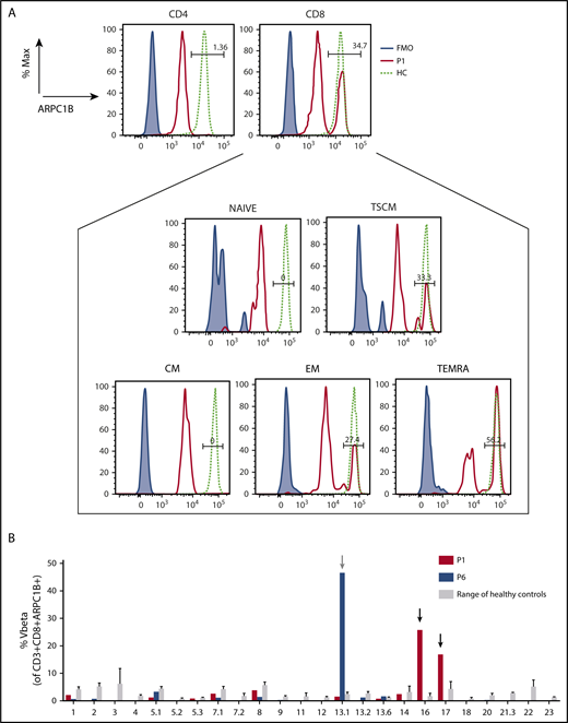 Figure 5. Characterization of revertant CD8+ T cells. (A) Histograms showing the presence of a revertant ARPC1B+ population in CD4+ and CD8+ compartments in freshly isolated PBMCs of P1 (red line) as compared with HC (dashed line). Blue line: negative control. Box represents the percentage of ARPC1B+ cells in naïve, central memory (CM), TSCM (CD3+CD8+CD45RA+CD62L+CD95+), EM (CD3+CD8+CD45RA−CD62L−), and TEMRA (CD3+CD8+CD45RA+CD62L−) gated on CD8+ T cells. P1, black line; HC, dashed line; negative control, blue line. (B) Determination of Vβ in gated CD3+CD8+ARPC1B+ T cells in P1 (red bars) and P6 (blue bars) as compared with HC (gray bars, n = 3). Mean ± SD. Arrows indicate relative expansion of Vβ.