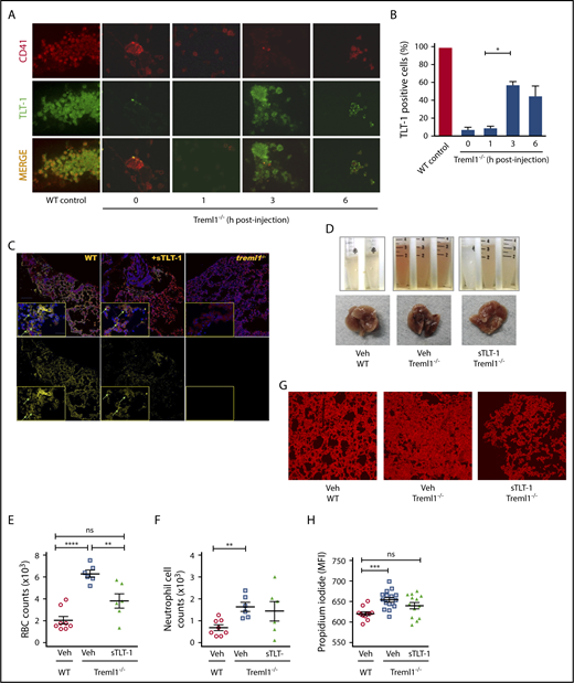 Figure 4. Soluble TLT-1 partially rescues bleeding and tissue damage in ALI model. (A) LPS-treated treml1−/− mice were injected IV with smTLT-1, and platelets were evaluated before injection (time 0), 1, 3, and 6 hours postinjection. Platelets were stained with voldemort and anti-rabbit-fitc secondary, and anti GPIIα IIIα-PE. (B) Quantification of the percentage of TLT-1 positive cells relative to WT (gray column). (C) Immunofluorescent staining of lungs from WT, treml1−/−, or treml1−/− mice treated with sTLT-1, 24 hours after LPS inhalation. CD41, red; TLT-1, yellow; 4′,6-diamidino-2-phenylindole, blue. (D-H) Treml1−/− mice were pretreated with either sTLT-1 or vehicle and then subjected to intranasal LPS challenge and evaluated at 24 hours. (D) Representative images of gross BALF and whole lungs, illustrating reduced bleeding in treml1−/− mice pretreated with sTLT-1. Pretreating treml1−/− mice with sTLT-1 reduced RBC counts (E), neutrophil influx into BALF (F), and PI staining of mouse lungs (G and H). Scale bar represents 100 μM (n = 5-6 mice per group; *P ≤ .05, **P ≤ .01, ***P ≤ .001, ****P ≤ .0001, 1-way ANOVA). Confocal images were processed using Nikon Confocal Microscope and analyzed using NIS element viewer 4.20, magnification ×20. All cytometric quantifications were done using BD Accuri C6 software (BD Biosciences). MFI, mean fluorescent intensity.