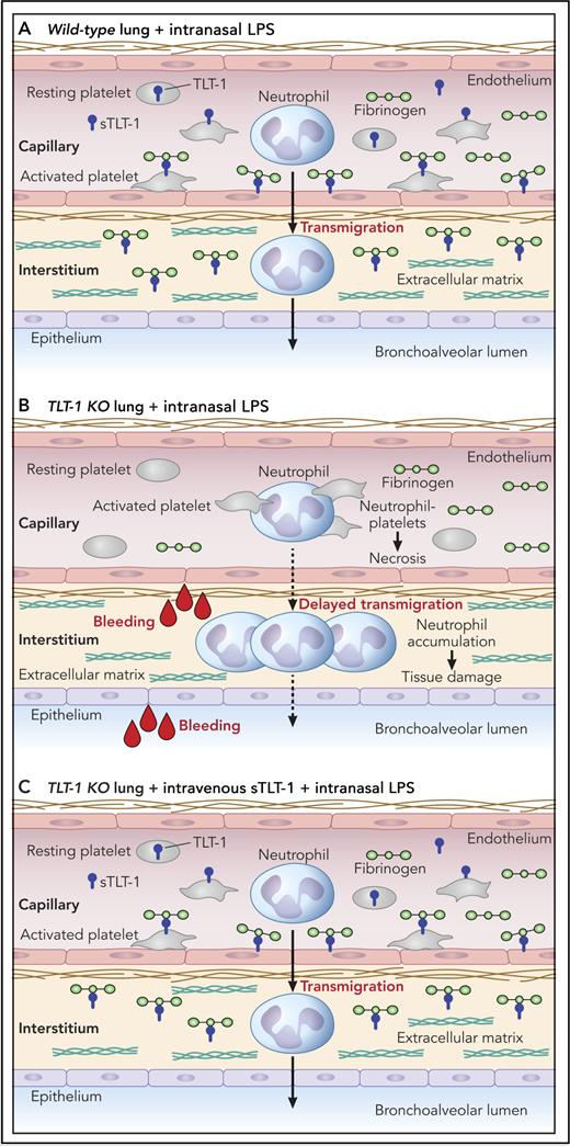 Schematic representation of lung response to intranasal lipopolysaccharide (LPS) treatment in (A) wild-type and (B) TLT-1 knockout (KO) mice. (C) Intravenous treatment with sTLT-1 rescues the LPS response in TLT-1 KO mice. Professional illustration by Patrick Lane, ScEYEnce Studios.