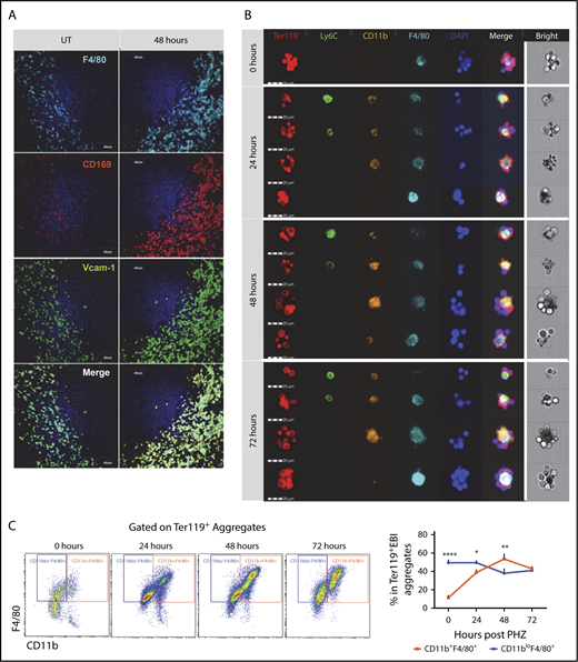 Figure 1. Ter119+ EBI phenotypes in stress erythropoiesis induced by PHZ. Mice were injected IP with a single dose of PHZ at 100 mg/kg body weight. Spleens were isolated and processed for spleen sections or for isolation of enriched EBI aggregates that were characterized for the expression of monocyte and macrophage markers by immunofluorescence microscopy or flow cytometry, respectively. (A) Immunofluorescence analysis of spleen sections from untreated (UT) or at 48 hours post-PHZ treatment. Each column shows sections were stained for F4/80, CD169, and Vcam-1 at the indicated time points. The stained sections were imaged using an Olympus Fluoview 1000 microscope at ×40 magnification. (B) FlowSight imaging of splenic Ter119+ EBIs at 0, 24, 48, and 72 hours post-PHZ treatment. Aggregates were stained with Ter119 to indicate erythroblasts and the monocyte macrophage markers Ly6C, F4/80, and CD11b. 4′,6-Diamidino-2-phenylindole (DAPI) staining was included to mark nuclei. Each horizontal strip represents 1 aggregate. All cells imaged used the same gating. The white vertical line separates the bright field image of aggregate from the fluorescent images. Scale bar: 20 μm. (C) Representative FlowSight gating charts (left). The percentage of CD11b+F4/80+ cells and CD11bloF4/80+ cells in Ter119+ EBIs at the indicated time points is shown (right). Bars are representative of mean ± SEM. n = 3-4 for each group per time point.