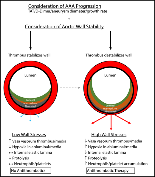 Figure 2. Determinations for antithrombotic treatment in patients with AAAs. Antithrombotic therapy, including antiplatelet drugs and anticoagulants, should likely be determined on a patient-to-patient basis. To assess whether patients should receive antithrombotic therapy, AAA progression and aortic wall stability should be assessed. With nominal aortic diameter growth, progression, and low wall stresses, antithrombotics should not be considered because the ILT may protect the wall from further harm. However, a destabilized thrombus with rapidly expanding aortic diameter, progression, and increased wall stress may benefit from antithrombotic therapy to prevent additional degradation of the vasculature, further weakening the aorta and resulting in rupture. Blue/thin arrows represent low outward force, whereas red/thick arrows represent high outward force. TAT, thrombin-antithrombin.
