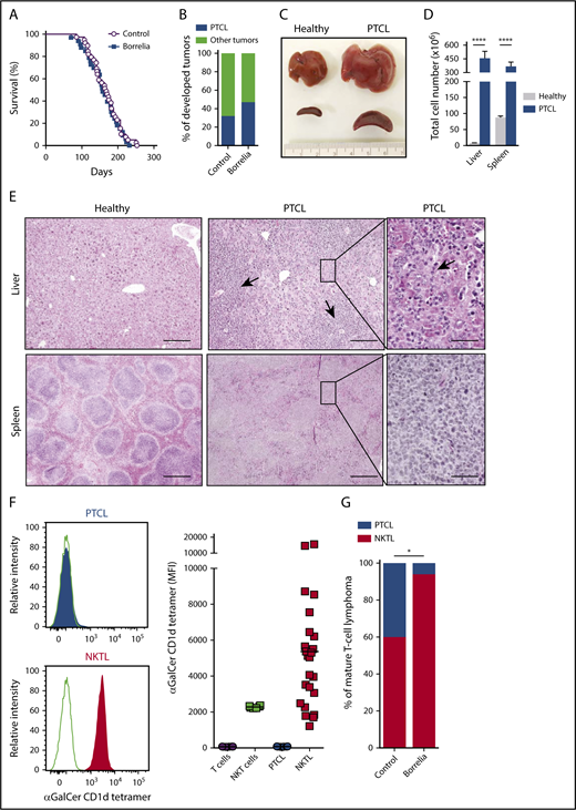 Figure 1. Borrelia infection increases the frequency of PTCL arising from NKT cells. (A) Survival curves of p53−/− mice infected with 5 × 104 spirochetes (n = 29) or control medium (n = 39). (B) Bar graph shows the tumor spectra developed in infected and control p53−/− mice. Other tumors include solid tumors and thymic lymphomas. (C) PTCLs are characterized by hepatosplenomegaly. Macroscopic images of livers and spleens from PTCL-bearing and healthy p53−/− mice. (D) PTCLs show a significant increase in cells in liver and spleen. Data are mean ± SD. ****P < .0001, Mann-Whitney U test. (E) Hematoxylin phloxine saffron (HPS) staining of paraffin-embedded organ sections from healthy and PTCL-bearing p53−/− mice. Arrows in middle panel indicate perivascular infiltrates of lymphoma cells. Arrow in the right panel denoted intrasinusoidal infiltrate of lymphoma cells. Scale bars, 200 µm (left and middle panels), 50 µm (right panels). (F) p53−/− mice develop 2 types of PTCL. Flow cytometry analysis of PTCLs (gated on the CD3+ Thy1.2+ population) stained with αGalCer-loaded CD1d tetramers. Line graphs are representative of 2 PTCL types: CD1d tetramer–negative PTCL (gray shading; PTCL) and CD1d tetramer–positive PTCL (red shading; NKTL) (left panels). CD1d tetramer staining of all PTCLs compared with normal T and NKT cells (right panel). (G) Borrelia infection increases the frequency of NKTL. PTCL and NKTL frequency among all PTCLs in control and Borrelia-infected p53−/− mice with significantly different PTCL spectra. *P < .02, χ2 test.