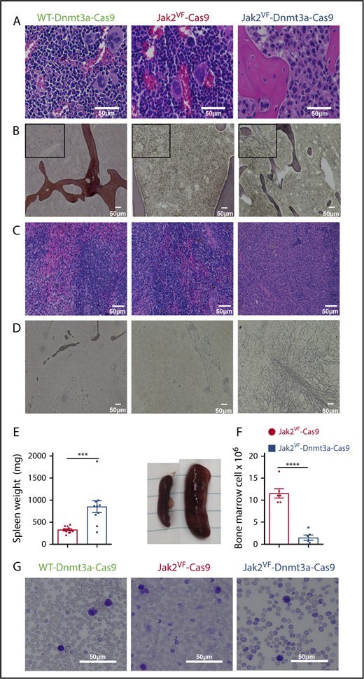Figure 3. Morphology of myelofibrotic transformation in bone marrow and spleen. (A) Representative image of BM of WT Dnmt3a-Cas9 (left), Jak2VF-Cas9 (center), and Jak2VF-Dnmt3a-Cas9 (right) LSK-transplanted mice at week 32. Scale bar, 50 µm; H&E stain. (B) Representative image of reticulin staining from BM of WT, Jak2VF-Cas9, and Jak2VF-Dnmt3a-Cas9 LSK-transplanted mice. Scale bar, 50 µm. Insets, Enlarged image. (C) Representative image of spleen of WT Dnmt3a-Cas9, Jak2VF-Cas9, and Jak2VF-Dnmt3a-Cas9 LSK-transplanted mice. Scale bar, 50 µm. (D) Representative image of reticulin staining from spleen of WT Dnmt3a-Cas9, Jak2VF-Cas9, and Jak2VF-Dnmt3a-Cas9 LSK-transplanted mice. Scale bar, 50 µm. (E) Spleen weight (left panel) and image (right panel) from Jak2VF-Cas9 and Jak2VF-Dnmt3a-Cas9 LSK-transplanted mice at week 32. P values were calculated using the unpaired Student t test, ***P < .001 mean ± SEM. (F) BM cell count from Jak2VF-Cas9 and Jak2VF-Dnmt3a-Cas9 LSK-transplanted mice. P values were calculated using the unpaired Student t test, ***P < .001 mean ± SEM. (G) Peripheral blood from WT Dnmt3a-Cas9, Jak2VF-Cas9, and Jak2VF-Dnmt3a-Cas9 LSK-transplanted mice. Scale bar, 50 µm; Wright-Giemsa stain.
