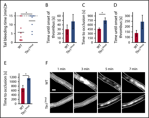 Figure 2. Hemostasis and thrombosis are reduced in Tln13mut mice. (A) Tail-bleeding time of WT and Tln13mut mice (cutoff at 15 minutes; n = 9). (B-C) Onset of thrombus formation (B) and vessel occlusion (C) measured in cremaster muscle venules of WT and Tln13mut mice after induction of phototoxic injury (n = 5). (D-E) Thrombus onset (D) and occlusion time (E) in injured cremaster muscle arterioles of WT and Tln13mut mice (n = 4). (F) Representative images of WT and Tln13mut cremaster muscle venules showing the progress of thrombus formation after 1, 3, 5, and 7 minutes. Scale bar, 25 µm. Values are given as means ± standard errors of the mean; n represents the number of mice. *P < .05.