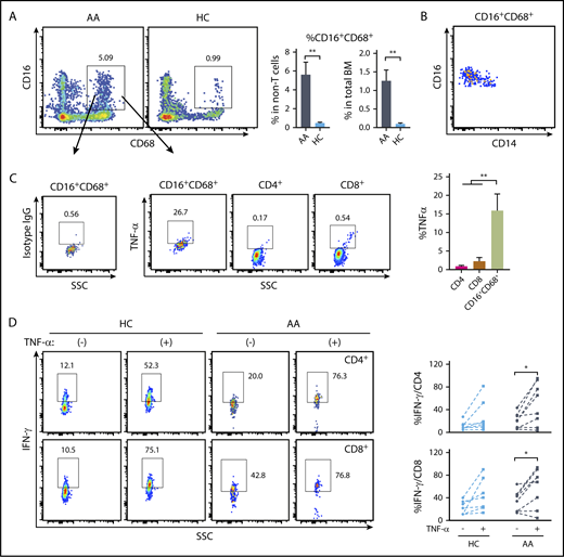 Figure 7. TNF-α expression by BM macrophages from AA patients and impact of TNF-α on human T-cell IFN-γ expression. (A) Comparison of the frequencies of BM macrophages (CD16+CD68+ in viable CD3− population) in AA patients (n = 8) and healthy controls (HC; n = 7). (B) CD14 and CD16 expression in CD16+CD68+ population. (C) Frequencies of TNF-α–producing cells in CD16+CD68+, CD4+, and CD8+ populations in AA patients detected by intracellular staining. Representative dot plots are shown. (D) Peripheral blood mononuclear cells (2 × 106/mL) from AA patients or healthy controls were stimulated with PMA (5 ng/mL) plus ionomycin (1 μM) in the presence or absence of human recombinant TNF-α (100 ng/mL) overnight. Intracellular IFN-γ levels in CD4+ T cells and CD8+ T cells from healthy controls (n = 7) and AA patients (n = 8) were examined by flow cytometry. *P < .05; **P < .01.