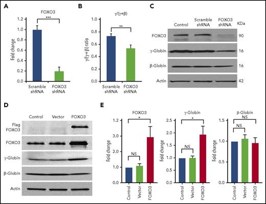 Figure 1. Knockdown of FOXO3 reduces γ-globin expression and protein levels relative to β-globin, and overexpression of FOXO3 increases γ-globin expression and protein levels relative to β-globin. (A) An 80% knockdown of FOXO3 is achieved. (B) Effects of FOXO3 knockdown on γ-globin and β-globin, as measured by RT-qPCR (3 independent assays). (C) Western blot depicting FOXO3 knockdown and its effect on γ-globin and β-globin protein levels. (D) Western blot depicting effects of FOXO3 overexpression on γ-globin and β-globin. (E) Quantification of western blot (3 independent assays). Error bar represents SD. ***P < .0001, **P < .005, *P < .05. NS, not significant.