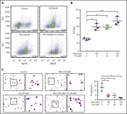 Figure 3. Metformin (Met) increases the number of HbF-expressing cells in HSPCs and prevents sickling under hypoxic conditions. (A) CD34+ cells from normal individuals were cultured under conditions to promote erythroid maturation. The indicated drugs were added at day 7 and samples were collected on day 14. HbF-immunostained cells (F cells) were measured by flow cytometry at day 14. (B) Aggregate of 3 independent assays. (C) CD34+ cells from a patient with SCD, treated with the indicated drugs from days 7 to 28. On day 28, cells were placed in 2% O2 for 4 hours, fixed, and stained with Wright/Giemsa; scale bars, 10 µm. Error bar represents SD from 3 experiments using CD34+ cells from 3 patients with SCD. ***P < .0001, **P < .005, *P < .01.