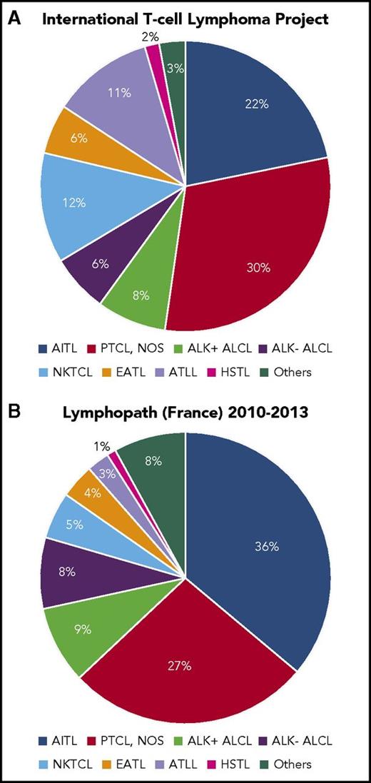 Figure 1. Relative frequencies of major T-cell entities. Reported by the International T-cell Lymphoma Project2 (A) and Lymphopath7 (B). NKTCL, nasal NK/T-cell lymphoma.