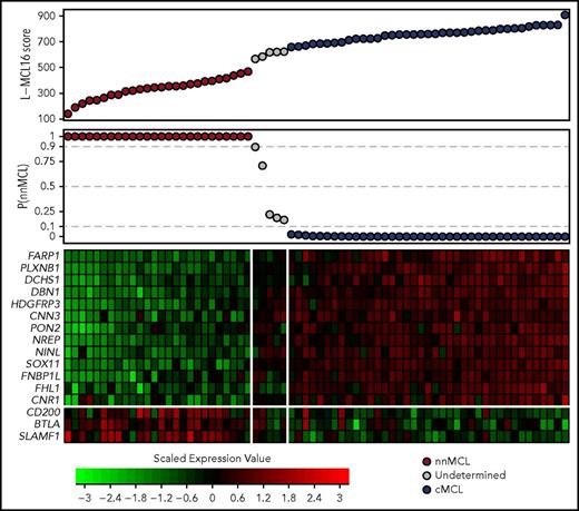 Figure 1. Gene-expression–based L-MCL16 scores in the validation cohort. L-MCL16 score for each validation sample in ascending order (top panel) and associated probability of membership in the nnMCL subgroup (middle panel). L-MCL16 signature heat map (13 upregulated genes in cMCL and 3 upregulated genes in nnMCL) (bottom panel); genes are shown in rows, and cases are shown in columns (red indicates high expression). Two clear gene expression patterns can be observed, with high scores corresponding to cMCL samples (blue) and low scores corresponding to nnMCL samples (red). Only 5 samples have an intermediate gene-expression pattern and are considered Undetermined (gray).