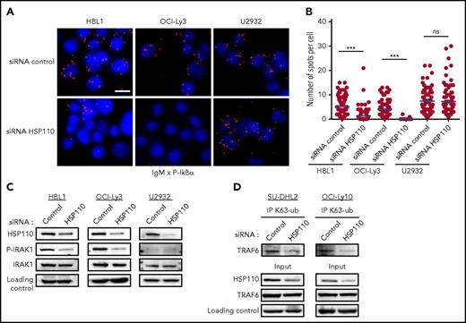 Figure 3. HSP110 intervenes upstream of the IRAK1-TRAF6 complex formation. (A) In cellulo interaction of IgM with p-IκBα was determined in HBL1, OCI-Ly3, and U2932 by Duolink technology after transfection with an siRNA targeting HSP110 or a control siRNA (n = 3; 1 representative image is shown). Scale bar represents 20 μm. (B) Quantitation of IgM–p-IκBα spots per cell determined by Duolink technology as in (A). (C) Immunoblot analysis of HSP110, p-IRAK1, and total IRAK1 in HBL1, OCI-Ly3, and U2932 cells at 48 hours after transfection with an siRNA targeting HSP110 or a control siRNA. β-actin served as a loading control (n = 3). (D) Immunoprecipitation of Lysine 63–linked polyubiquitin chain (K63-ub) in SU-DHL2 and OCI-Ly10 cells 48 hours after transfection with an siRNA targeting HSP110 or a control siRNA, followed by immunoblot using a TRAF6 antibody. Immunoblot of total cell extract (input) shows HSP110 and TRAF6 analysis (n = 3). ***P < .001.