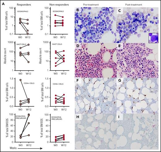 Figure 4. Bone marrow cellular composition at baseline and 12 weeks after treatment with dexpramipexole. (A) Eosinophils, mast cells, CD34+ cells, and eosinophil precursors in the 4 responders and 6 delayed or nonresponders at baseline (predrug) and again at week 12 (on dexpramipexole). (B-I) Bone marrow aspirate and biopsy specimens in a responder (subject 15) at baseline and again at 12 weeks on dexpramipexole. Pretreatment bone marrow aspirate (B; Wright-Giemsa staining) and biopsy (D; hematoxylin and eosin staining) show increased eosinophils. Week 12 (on dexpramipexole) counterparts (C,E) demonstrate absence of eosinophils. Rare eosinophilic promyelocytes were noted after treatment (E, inset). The number of tryptase-positive mast cells (F-G) and CD34+ precursors (H-I) in the biopsy specimens did not to change with treatment. Original magnification ×500 for panels B-E; magnification ×200 for panels F-I. Cell enumeration and flow cytometric assay details are included in supplemental Methods. BM, bone marrow; W, week.
