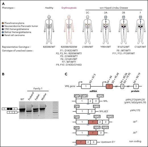 Figure 1. Clinical manifestations of patients carrying VHL mutations and identification of a new VHL spliced isoform containing a cryptic exon. (A) Mutations in the VHL gene predispose to different phenotypes. VHL disease is characterized by the development of central nervous system (CNS) and retinal hemangioblastomas, neuroendocrine pancreatic tumors, pheochromocytomas, and clear cell renal cell carcinomas. Chuvash polycythemia (erythrocytosis) is characterized by elevated red blood cell numbers. This study describes families with typical VHL-related phenotypes associated with an unexpected VHL status (ie, either synonymous mutations or no alterations in VHL). (B) Reverse transcription polymerase chain reaction (RT-PCR) using primers specific for E1 and E3 was performed on messenger RNA (mRNA) extracted from lymphoblastoid cell lines (LCLs) established from controls and patients of family 1 (F1). (C) Schematic representation of the VHL gene and its products. The different VHL exons are represented on a scale: E1, 340 bp from the ATG initiation codon; E1′, 259 bp; E2, 123 bp; E3, 179 bp to the Stop termination codon. The full-length VHL mRNA isoform encodes pVHL213 (also named pVHL30). VHL E1 contains an internal translation initiation codon that initiates the production of pVHL160 protein (pVHL19). The isoform containing E1 spliced in phase with E3 encodes pVHL172 that lacks E2. The isoforms containing E1 spliced with E1′ may theoretically encode a protein termed X1 of 193 aa (114 aa encoded by E1, and 79 aa encoded by E1′). Consensus values of donor (SD) and acceptor (SA) splice site sequences are indicated above the VHL gene, as calculated by the human splicing finder in silico tool. Horizontal blue lines indicate the location of probes used in TaqMan assays. *Denotes larger fragments that were subsequently cloned and sequenced. †The isoforms containing E1′ spliced with VHL exons were identified by cloning and sequencing in the laboratory but were described later by the National Center for Biotechnology Information as transcripts able to produce a protein termed X1. WT, wild type.
