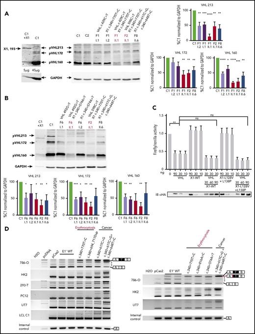 Figure 4. Functional studies of mutations in VHL E1′. (A-B) Immunoblot analysis of patient LCLs. A representative immunoblot (A) and quantification of 3 different immunoblots (B) are presented. Relative gene expression was normalized to glyceraldehyde-3-phosphate dehydrogenase (GAPDH) expression, and results obtained with LCL control (C1) were fixed at 100%. Data are represented as the mean ± standard error of the mean. A VHL antibody that recognized VHL E1 was able to detect the hypothetical X1 protein. In the most left lane, control LCLs were transfected with an expression vector containing the coding sequence for X1; 5 µg of proteins were blotted vs 45 µg for other samples to avoid signal saturation with overexpressed X1. Patients with erythrocytosis are indicated in red. (C) Functional hypoxia response element (HRE)–dependent reporter assays were performed in 786-O cells (ie, VHL− cells that constitutively express HIF-2α). The results are expressed as relative firefly luciferase activity with Renilla luciferase as an internal control; 1.0 unit denotes the basal activity of endogenous HIF-2α using the HRE luciferase reporter plasmid. The ability of WT and mutated X1 to downregulate firefly luciferase activity (related to HIF activity) was compared with pVHL and in competition with pVHL. An immunoblot using an antibody specific to the hemagglutinin tag (HA) was used to detect HA-VHL and HA-X1. X1-L128V+L138P corresponds to a potential impact of the c.340+648T>C and c.340+617C>G mutations on the hypothetical X1 protein. Three independent experiments were performed. (D) Characterization of VHL E1′ retention by the minigene experiment (representative picture of agarose gel; n = 3). RT-PCR was performed on mRNA obtained from cell lines transfected with a minigene construct containing VHL E1′ (WT or mutated) flanked by large intronic sequences cloned between the SERPING1 exons (exons A and B, targeted by the RT-PCR primers). The plasmids were transfected, and the expression of the spliced chimeric transcripts (containing EA and EB ± E1′) was analyzed. Two WT constructs containing E1′ were used; 1 contained the single-nucleotide polymorphism c.340+1150T>C (rs779808). Bands corresponding to EA and EB spliced together or with VHL E1′ are indicated on the right. *P < .05, **P < .01, ***P < .001, ****P < .0001 based on Student t test. †Corresponds to unspecific bands verified by sequencing. The minigene experiment performed with the construction carrying the mutation c.340+574A>T (that targets the SA site of E1′ in F6) confirmed the use of an alternative SA site (right panel) with the deletion of 15 nucleotides (represented in red). ns, not significant.