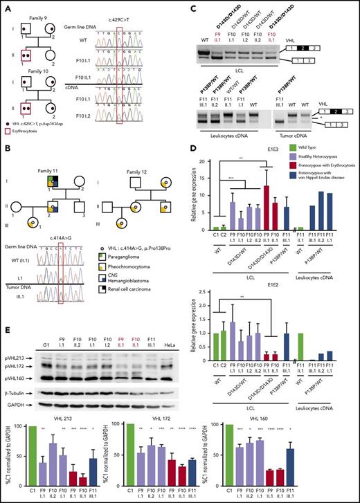 Figure 5. Genetic and expression study of synonymous mutations in VHL E2. (A-B) Pedigree and sequence chromatograms of germline DNA, tumor (pheochromocytoma) DNA, or cDNA prepared from 2 families (F9 and F10) with erythrocytosis (A) and 2 families (F11 and F12) with VHL disease (B). (C) Results of RT-PCR using mRNA extracted from LCLs (F9 and F10) and leukocytes and tumor material (pheochromocytoma) (F11 and F12). (D) TaqMan quantification of the different VHL isoforms in LCLs (established from patients of F9, F10, and F11) cultured in the absence or presence of puromycin. TaqMan probes are specific to the VHL E1-E2 or E1-E3 junction. Relative gene expression was normalized to LCL control (C1). (E) Immunoblot analysis of patient LCLs. Patients with erythrocytosis are indicated in red. A representative immunoblot (upper panel) and quantification of 4 different immunoblots are displayed (lower panel). Relative gene expression was normalized to glyceraldehyde-3-phosphate dehydrogenase (GAPDH) expression, and results obtained with C1 were fixed at 100%. Data are represented as the mean ± standard error of the mean. *P < .05, **P < .01, ***P < .001, ****P < .0001 based on Student t test. CNS, central nervous system.