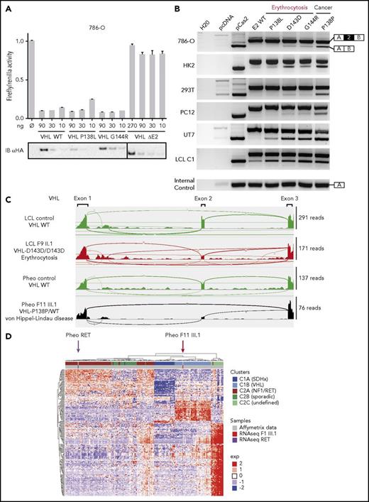 Figure 6. Functional study of synonymous mutations in VHL E2. (A) Functional hypoxia response element (HRE)–dependent reporter assays were performed in 786-O cells to evaluate the impact of VHL mutations in E2 (P138L and G144R) on VHL protein activity. The VHL protein lacking E2 (pVHL172/VHLΔE2) was used as a negative control. The results are expressed as firefly luciferase activity relative to Renilla luciferase as an internal control; 1.0 unit denotes the basal activity of endogenous HIF-2α using the HRE luciferase reporter plasmid. Immunoblots using an antibody specific for the hemagglutinin tag (HA) were used to detect HA-VHL. (B) Characterization of VHL E2 skipping by minigene analyses. Minigene experiments were performed in a variety of cell lines relevant to the studied diseases: renal (293T, 786-O, and HK2), pheochromocytoma (pheo; PC12), erythroid cell line (UT7 cultured with erythropoietin), and LCL. RT-PCR was performed on mRNA obtained from cell lines transfected with a minigene construct containing VHL E2 flanked by intronic sequences cloned between the SERPING1 exons (exons A and B; targeted by the RT-PCR primers). Bands corresponding to EA and EB spliced together or with VHL E2 are indicated on the right. (C) Sashimi plots from RNA-seq data. The positions of the different VHL exons are indicated, with the maximum number of reads for each exon indicated at the right. Splice junctions are denoted by the horizontal links, with details provided in supplemental Figure 15A. (D) Heatmap of pheochromocytoma transcriptome data. A comparison of transcriptome data for the pheochromocytoma from patient F11 III.1 (with P138P mutation) vs Affymetrix data from the largest available cohort of paragangliomas/pheochromocytomas (recruited by the French COMETE network) that identified homogeneous molecular subgroups associated with susceptibility genes (Burnichon et al30).