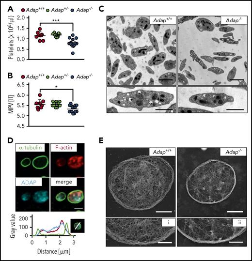 Figure 1. Microthrombocytopenia in ADAP-deficient mice. (A) Platelet count per microliter and (B) MPV were determined from Adap−/−, Adap+/− and control mice by a hematology analyzer. (A-B) Values are mean ± standard deviation (SD; n = at least 8). ***P < .001; *P < .05. (C) Transmission electron micrographs from Adap+/+ and Adap−/− platelets; scale bars represent 2 µm (top panel) and 1 µm (bottom panel). (D) ADAP localization in resting control platelets was assessed by confocal microcopy; scale bar represents 2 µm. Line plot histogram of the marked platelet in the bottom right corner. (E) Images of the platelet cytoskeleton ultrastructure on poly-l-lysine. Scale bars represent 1 µm (top panel) and 0.5 µm (bottom panel; i, ii).