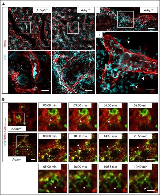 Figure 4. Release of (pro)platelet-like particles next to the vessels in ADAP-deficient mice. (A) Maximum projection of 60 µm z-stacks obtained by confocal microscopy from sternal BM of control and ADAP-deficient mice. Vessels (red; CD105), MKs (cyan; GPIX). Sternum was fixed and cleared for imaging. Scale bars represent 50 µm (top panel; left) and 20 µm (bottom panel; left). Bottom panel, Digital magnification of the region marked in the top panel. (i, ii) Maximum projection of a 25 µm z-stack from a sternum of an ADAP-deficient mouse. Scale bars represent 30 µm (i) and 10 µm (ii). Arrowheads in (ii) point to proplatelets released into the BM compartment. (B) Intravital 2-photon microscopy of proplatelet formation in the skull at the indicated time points. Vessels were visualized by staining of CD105 and with tetramethylrhodamine-dextran (TMR-dextran; red); MKs/platelets are shown by GPIX staining (green). Scale bars represent 50 µm (top and middle panel) and 10 µm (bottom panel). Arrowheads point to proplatelets (top and middle panel), arrows point to platelet-like particle released into the BM compartment (bottom panel) in the region marked with an asterisk (middle panel, left).
