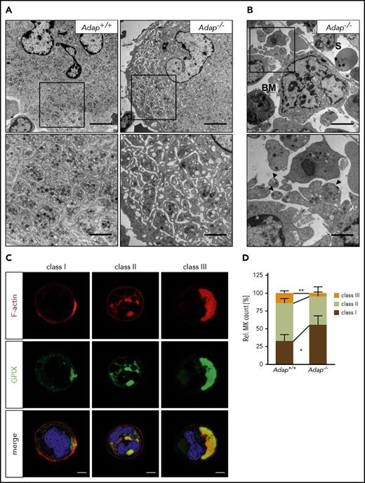 Figure 5. Defective DMS polarization of ADAP-deficient MKs in vitro. (A-B) Transmission electron micrographs from intact BM of control and ADAP-deficient mice. Scale bars represent 5 µm (top panel) and 2 µm (bottom panel, inset). (B) Release of (pro)platelet-like particles into the BM compartment (BM) next to a sinusoid (S) (top panel). Higher magnification of released (pro)platelet-like particles (arrowheads; bottom panel). (C) Representative confocal images of Adap+/+ MKs cultured in vitro for 5 days and stained for F-actin (red), GPIX (green), and the nucleus (blue). According to the localization of GPIX and F-actin as well as the position of the nucleus 3 classes were defined (class I-III). Scale bar represents 10 µm. (D) Quantitative analysis of the distribution of the 3 MK classes in vitro on day 5 of cultivation. Five hundred MKs per genotype were analyzed. Values are mean ± SD (n = 5) (**P < .01; *P < .05).