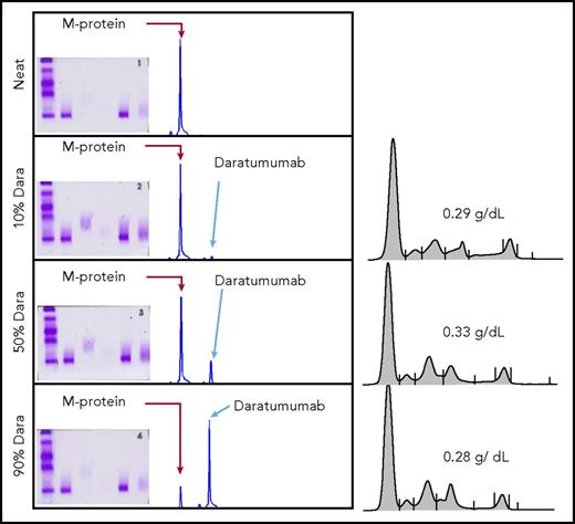 Figure 2. Mixing study demonstrating the superior resolution of miRAMM as compared with serum protein electrophoresis and IFE for distinguishing and quantitating M-proteins in the presence of daratumumab. Residual patient sera with an endogenous M-protein comigrating with daratumumab was mixed with different concentrations of daratumumab to achieve a 0.3 g/dL final concentrations with the following compositions: 0.27 g/dL daratumumab and 0.03 g/dL comigrating M-protein, 0.15 g/dL daratumumab and 0.15 g/dL comigrating M-protein, and 0.03 g/dL daratumumab and 0.27 g/dL of comigrating M-protein.