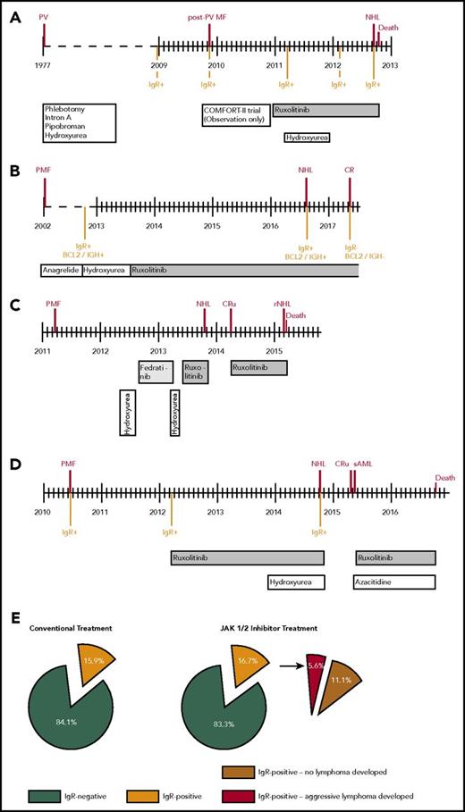 Figure 1. Clinical courses of 4 patients who developed aggressive B-cell lymphomas during JAK1/2 inhibition. Timelines (A-D). Frequencies of immunoglobulin rearrangement in the bone marrow during myelofibrosis and lymphoma development in conventionally treated patients (N = 44) compared with patients treated with JAK1/2 inhibitor (N = 54) (E). NHL, non-Hodgkin lymphoma; CR, complete remission; CRu, complete remission unconfirmed; rNHL, remission of NHL; sAML, secondary acute myeloid leukemia.