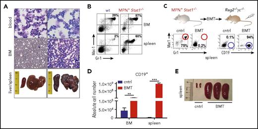 Figure 2. MPN and B-cell malignancy coexist in Stat1−/− mice. (A) Representative smears (BM, PB, original magnification: 40×; hematoxylin and eosin stainings) and photographs of spleens and livers. (B) Presence of Gr1+Mac1+ cells of wt and MPN+ Stat1−/− animals (FACS; BM, spleen). One representative example per genotype is shown in (A) and (B). (C) FACS analysis of Gr1+Mac1+ and CD19+ (spleen). One representative example per experimental group is shown. (D) Absolute cell numbers of CD19+ cells in BMs and spleens of transplanted mice (n = 3 each). Data represent means ± SD; BM cntrl vs BM Stat1−/− recipient. **P < .01; ***P < .001). (E) Representative photographs of spleens of control (phosphate-buffered saline injected) and BMT mice.