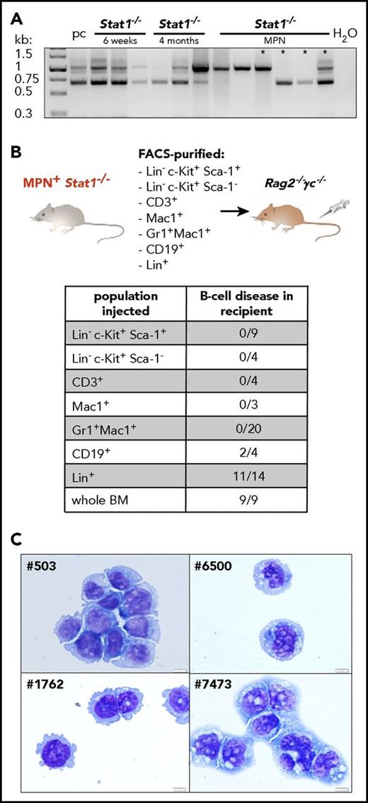Figure 3. Stat1−/− mice recapitulate the phenotype of coexisting MPN and B-cell transformation. (A) BM of Stat1−/− mice with 6 weeks of age (n = 3), 4 months of age (n = 3), and Stat1−/− MPN+ mice (n = 6) was analyzed for D-J rearrangement of the IgH gene. Pc, polyclonal B cells (derived from splenocytes of a wt mouse). Asterisks denote samples of those mice, whose B-cell clonality was followed in subsequent transplantations (outlined in supplemental Figure 5C). (B) BMs or spleens of MPN+ Stat1−/− mice were fractionated into LSK (Lin− Sca-1+c-Kit+), progenitors (Lin− c-Kit+Sca-1−), CD3+, Mac1+, Gr1+Mac1+, CD19+, and Lin+ cells and intravenous injected into Rag2−/−γc−/− mice. Table shows incidence of B-cell disease in recipient mice that had received individual populations or whole BM. (C) Cytospins of Stat1−/− B-cell lines: #503, #1762, #6500 and #7473. Original magnification: 40×. Scale bar, 10 μm.