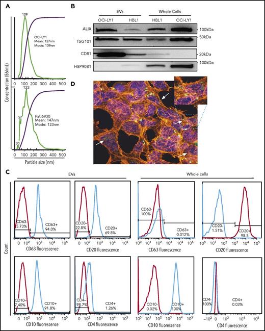 Figure 1. Isolation of EVs from DLBCL cell lines and primary sample. (A) Size distribution and concentration of EVs isolated from OCI-Ly1 cell line (top) and a primary DLBCL sample of GCB subtype (bottom) by ultracentrifugation determined by the NanoSight instrument. (B) Western blot for the exosomal proteins ALIX (100 kDa), TSG101 (46 kDa), CD81 (26 kDa), and as a negative control, HSP90B1 protein (90 kDa). (C) FACS analysis of exosomal surface markers demonstrates expression of CD63 in OCI-Ly1–derived EVs but not in the parental whole cells, expression of B-cell surface marker CD20, GC marker CD10, but not T-cell marker CD4 in both derived EVs and parental OCI-Ly1 cells. (D) Confocal fluorescence microscope image shows uptake of EVs released by lymphoma OCI-LY1 cells (green) by stromal HK cells (blue = DAPI; red = α-actin).