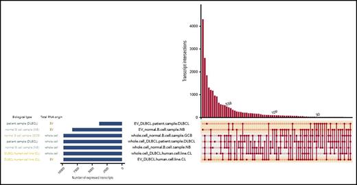 Figure 4. Intersecting sets of transcripts across EVs and whole cell content. Depiction of all possible transcript overlap sets among the DLBCL cell lines, primary samples, normal B cells, and their corresponding EVs. Samples are listed on the left with the blue bar indicating the number of expressed RNA transcripts. On the right panel, the average of TPM values was plotted in this graph for each transcript isoform from each sample type (EV-normal B, EV-primary DLBCL, etc). Then, to restrict the analysis to the most abundant transcripts, the top 5% expressed transcripts from each sample type were selected and analyzed for overlapping transcripts. The intersections of sets are a matrix in which the rows represent the sets and the columns represent their intersections. The number of shared transcripts is indicated in the y-axis. Overlaps are sorted in decreasing size, and the shaded circles connected by solid lines in the lower panel indicate the intersecting samples.