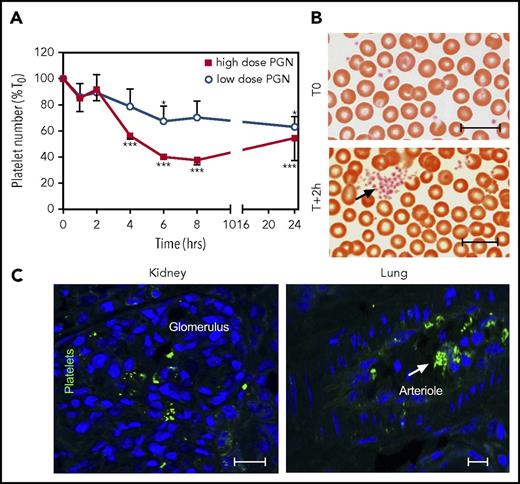 Figure 5. PGN induces platelet activation in challenged baboons. (A) PGN challenge induces progressive thrombocytopenia in baboons in a dose-dependent manner. Data representation and statistical analysis are consistent with Figure 1. (B) Representative micrographs of Giemsa-stained serial blood smears from high-dose PGN group highlighting circulating platelet aggregates (arrows) in challenged baboons. Images were acquired on an upright Nikon Eclipse E800M microscope equipped with an Omax high-speed digital camera using the Omax ToupView software. (C) Immunofluorescence analysis of platelet activation in peripheral tissues of high-dose PGN-challenged primates at end point. Conformational changes in active GPIIbIIIa integrin were detected using the PAC-1 monoclonal followed by fluorescein isothiocyanate (FITC)-labeled donkey anti-mouse secondary (Jackson ImmunoResearch). DAPI was used for nuclear counterstaining. Confocal images were acquired on a Nikon Eclipse TE2000-U inverted microscope equipped with a Nikon C1 scanning head using EZ-C1 software. Representative micrographs from kidneys (left) and lung (right) sections from high-dose PGN-challenged baboons are shown. Scale bars represent 20 µm.