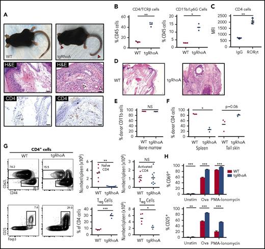 Figure 2. TgRhoA mice develop hematopoietic cell-dependent autoimmunity. (A) Gross findings demonstrating fibrosis of ears and tail (red arrowheads) of mice from the indicated genotypes (top). Hematoxylin and eosin (H&E) staining of mouse tail tips demonstrating a polymorphonuclear cell infiltrate (white arrowheads) and immunohistochemistry of CD4-positive cells (bottom). Scale bars, 100 μm. (B) Percentage of CD4/TCRβ and CD11b/Ly6G cells among CD45+ hematopoietic cells recovered from tail skin. (C) Mean fluorescence intensity of RORγt expression in tgRhoA CD4+ cells compared with isotype control (P = .0076). (D) H&E staining of tail tips from congenic recipient mice 10 weeks after injection with WT or tgRhoA bone marrow. Scale bars, 100 μm. (E) Flow cytometric analysis of bone marrow donor (CD45.1−) CD11b+ cells. (F) Flow cytometric analysis of bone marrow donor (CD45.1−) CD4+ cells in spleen or recovered from tail skin. (G) Representative flow cytometric profiles of splenic CD4+ naive and activated (top) or Treg populations (bottom) along with quantification. Plots and graphs are representative of 3 experiments. (H) Expression of activation markers from sorted CD4+CD62L+CD44−CD25−-naive T cells 48 hours after mixed leukocyte reaction of tgRhoA-OT-II or WT-OT-II T cells unstimulated, stimulated with 5 μg/mL OVA323-339 peptide, or stimulated with PMA/Ionomycin. Data are representative of 2 independent experiments. All P values calculated by t test with Welch’s correction.